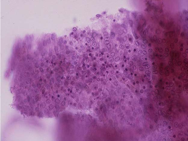 aquatic ShrimpDis2 img 7